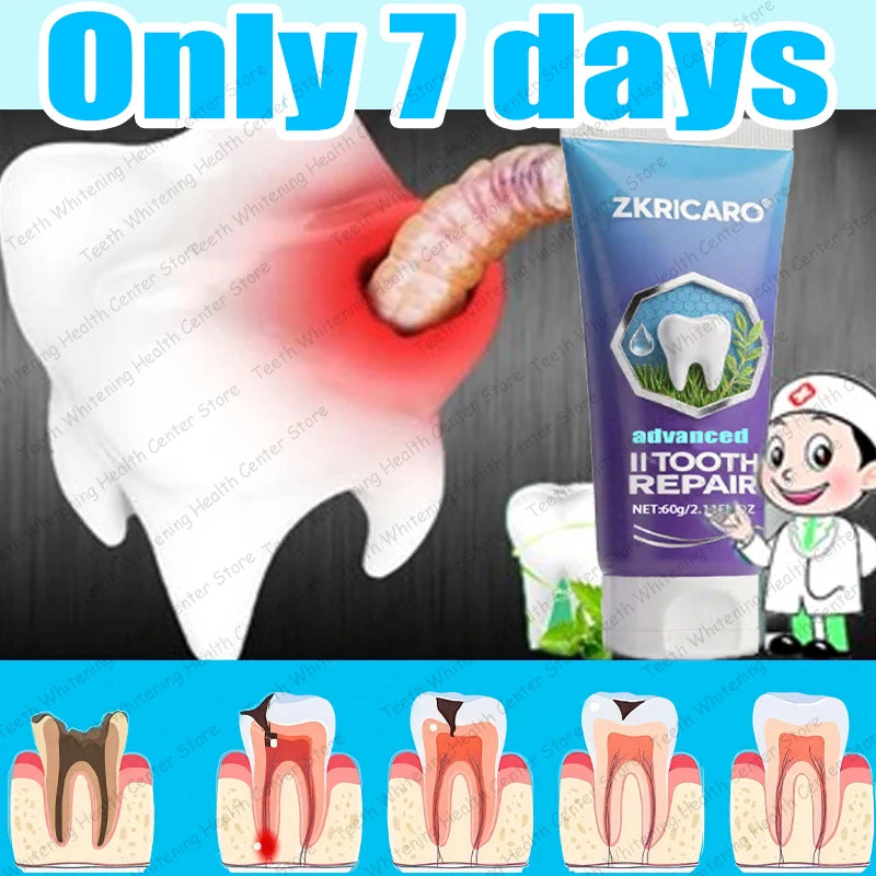 Hot sale, many people repurchase toothpaste to repair tooth decay