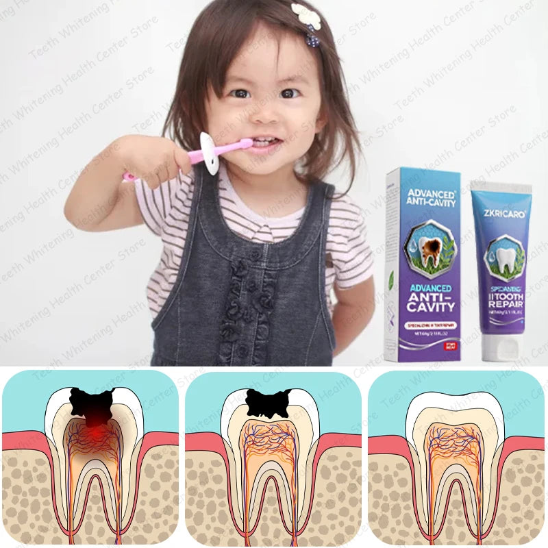 Hot sale, many people repurchase toothpaste to repair tooth decay