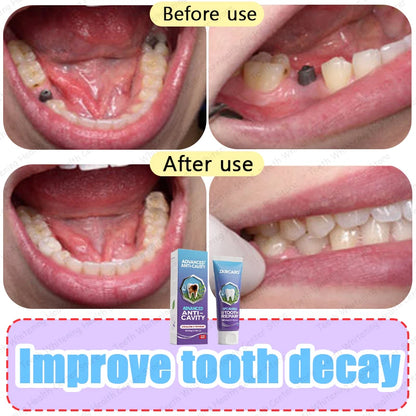 Hot sale, many people repurchase toothpaste to repair tooth decay